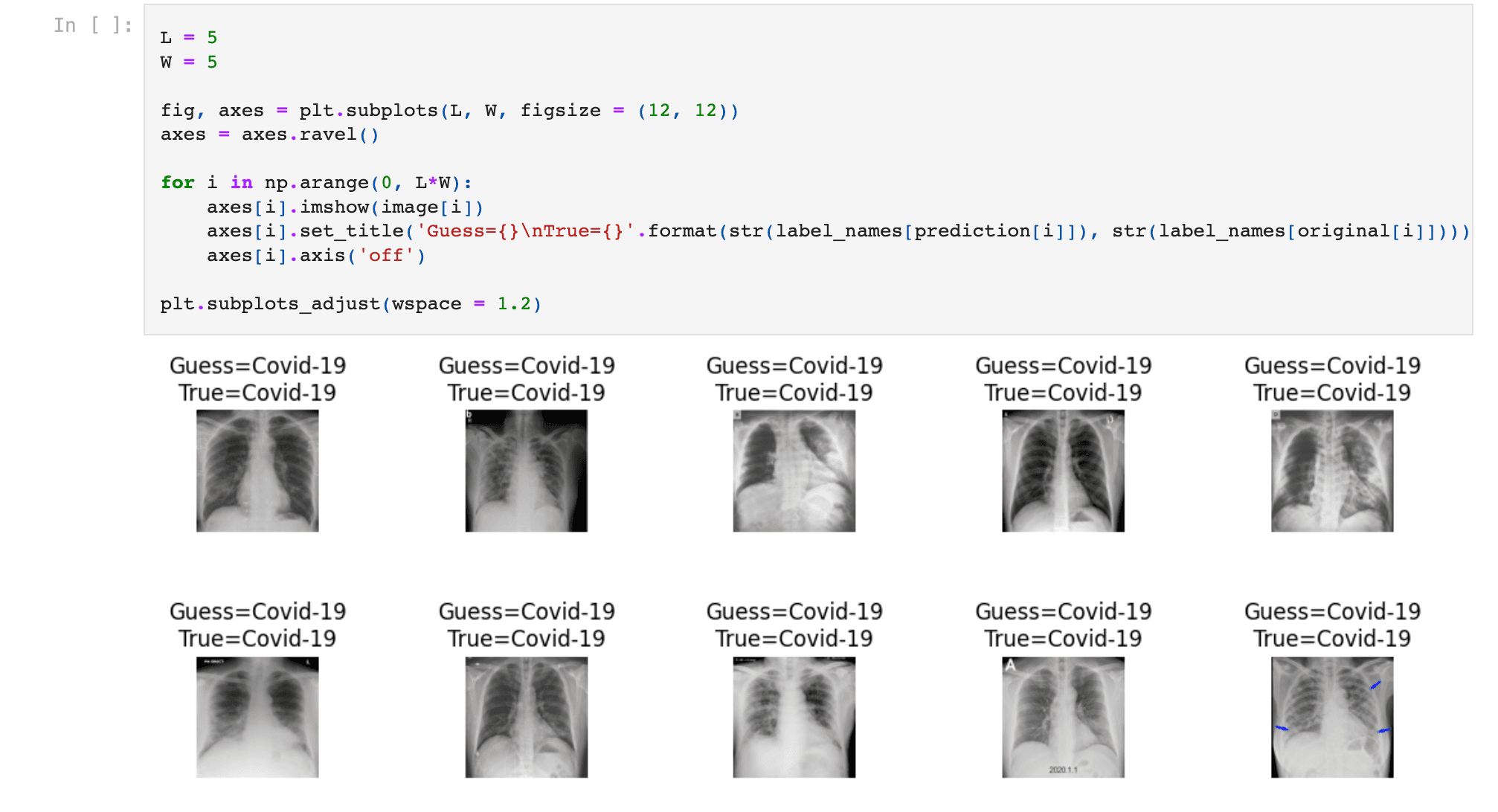 X-ray Chest Classification (Deep Learning)